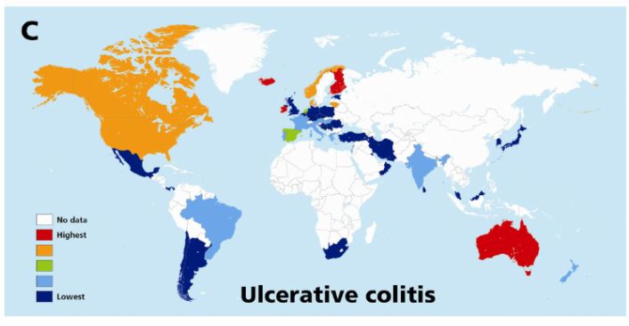 Kaj je ulcerozni kolitis - razširjenost v svetu